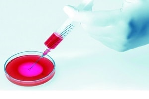 Diagnostic In Vitro