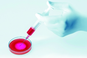 In Vitro Diagnostic Medical Devices